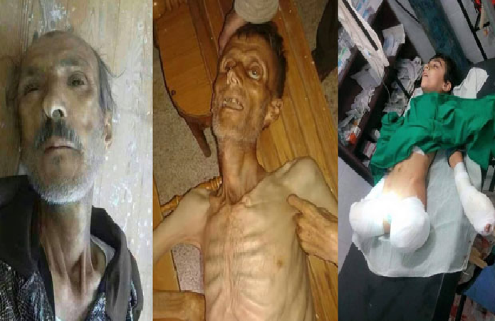   به‌ وێنه‌.. منداڵانی مه‌زایا له‌ برسان ده‌مرن